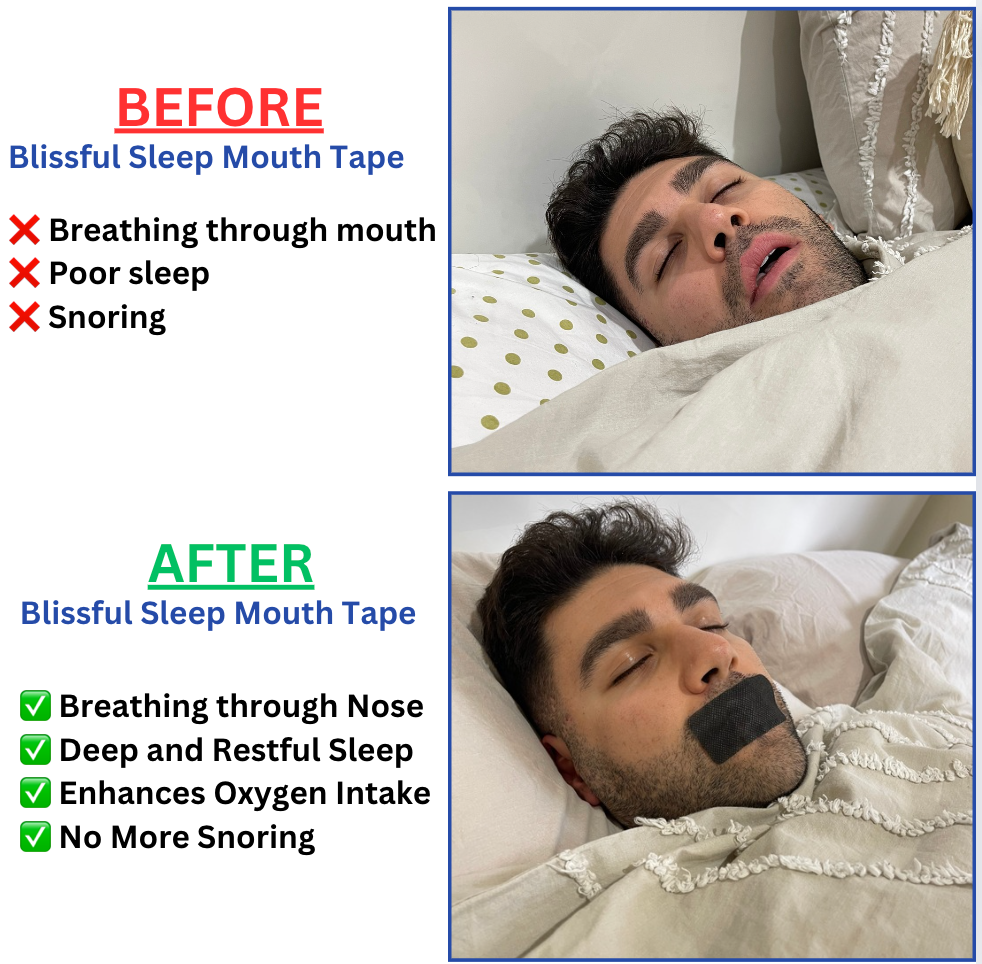 Blissful Sleep Mouth Tape